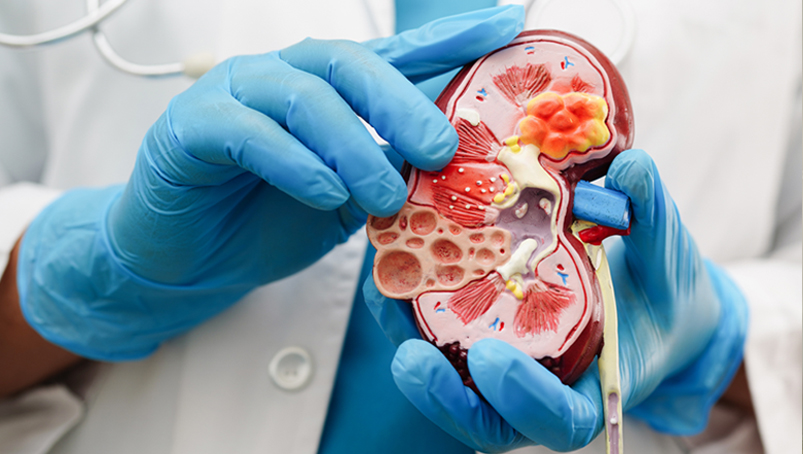 Acute Kidney Disease