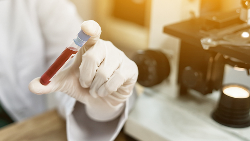Blood in a vial held by a medical person
